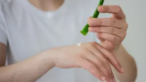 Applicazione di aloe sotto forma di gel sulla mano