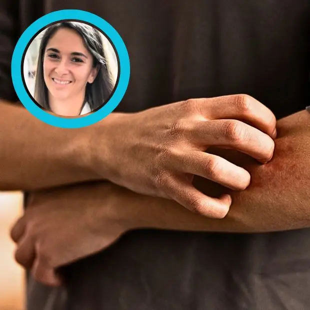 Allergia da nichel, una sfida quotidiana. I segnali del corpo e i passi per difendersi