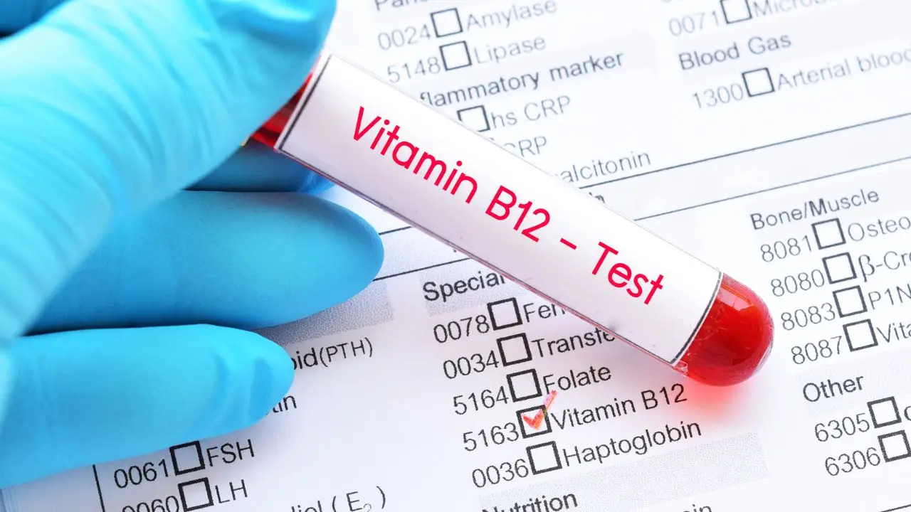Provetta per l'analisi della B12 nel sangue
